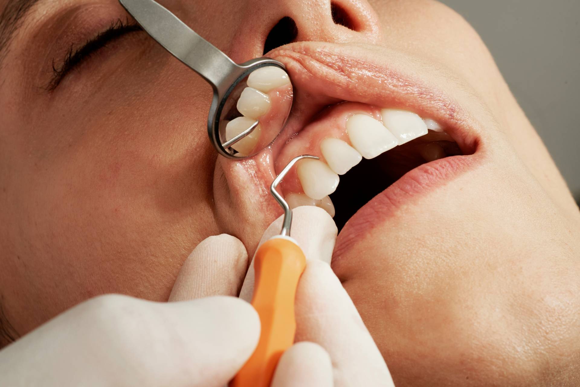 Avevo paura del dentista, poi ho conosciuto loro